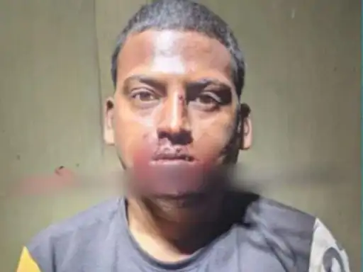 युवक के गले में फंसा 150 साल पुराना त्रिशूल:ऑपरेशन के लिए 65KM का सफर कर पहुंचा अस्पताल