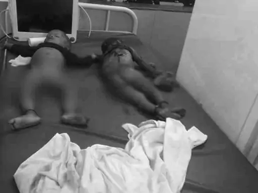 MP के मजदूरों से भरी ट्रैक्टर-ट्रॉली महाराष्ट्र में पलटी