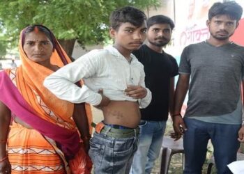 प्रतापगढ़ : ऑपरेशन पथरी का और निकाल ली किडनी, दवा बंद होने पर उठा दर्द, अल्ट्रासाउंड होने पर खुलासा