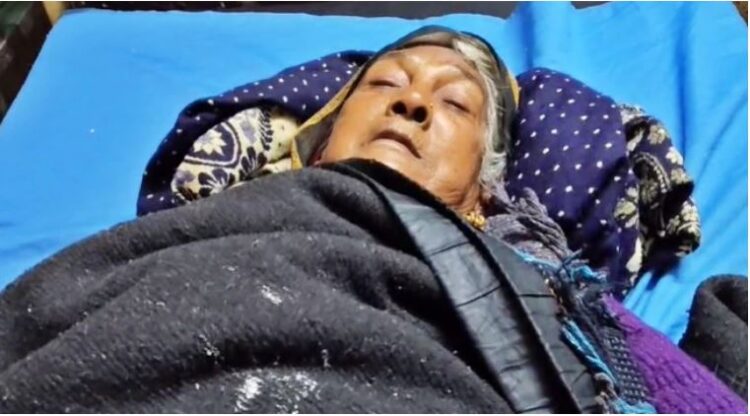 गजब! फ्रैक्चर महिला के बाएं पैर में था, डॉक्टर ने ऑपरेशन कर दिया दाएं का… अस्पताल ने कहा- मिस्टेक हो गई