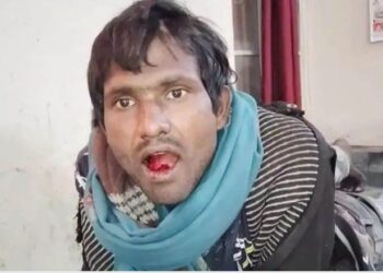 घर में सो रही थी महिला, तभी युवक जाकर करने लगा ये हरकतें; शोर मचाया तो अपनी जीभ काटकर कूड़े में फेंक डाली